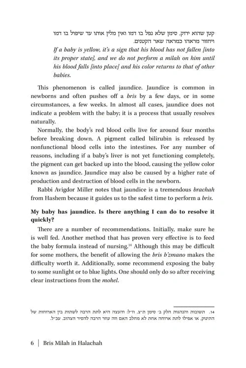 Bris Milah in Halachah